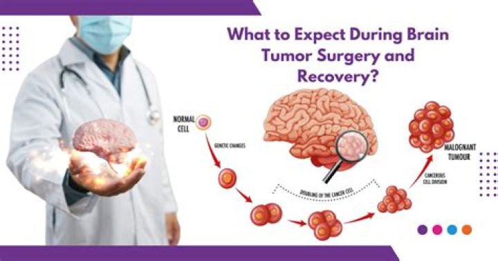 Brain Tumors & Eye Exams: What You Need to Know - Health Insights