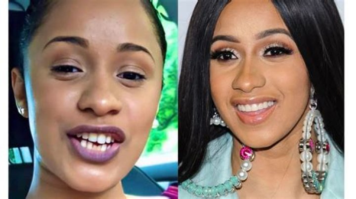 Cardi B's Teeth Transformation: Before And After, Revealed!