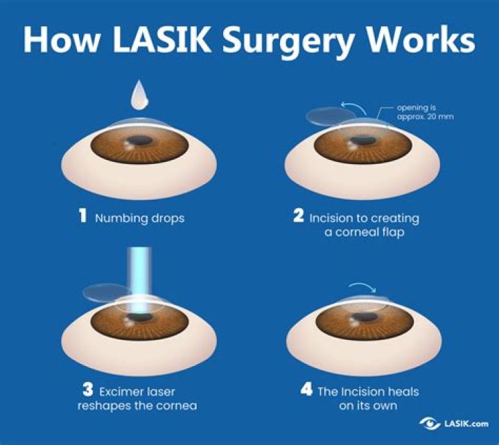 Kash Patel's Eye Surgery: What You Need to Know