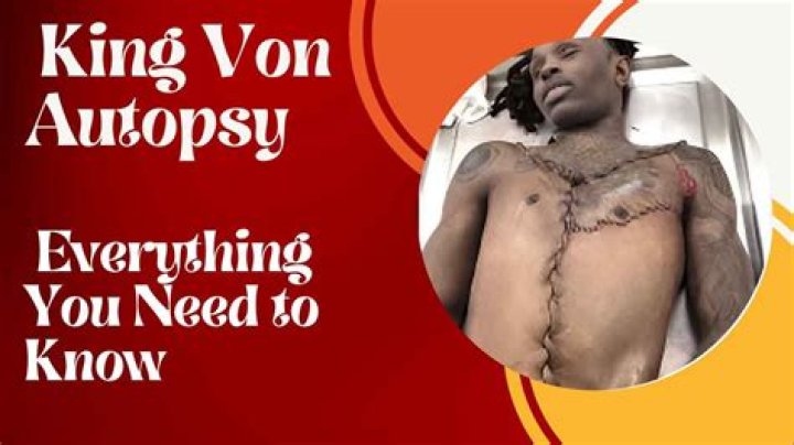 King Von Autopsy Report: What the Findings Revealed