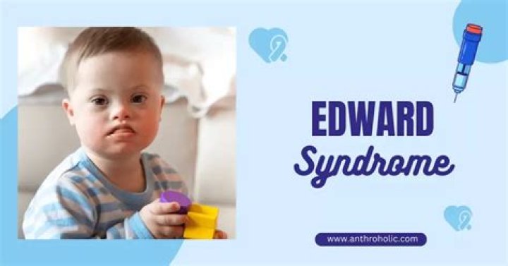 Unveiling Edward Bluemel Syndrome: Causes, Symptoms & More